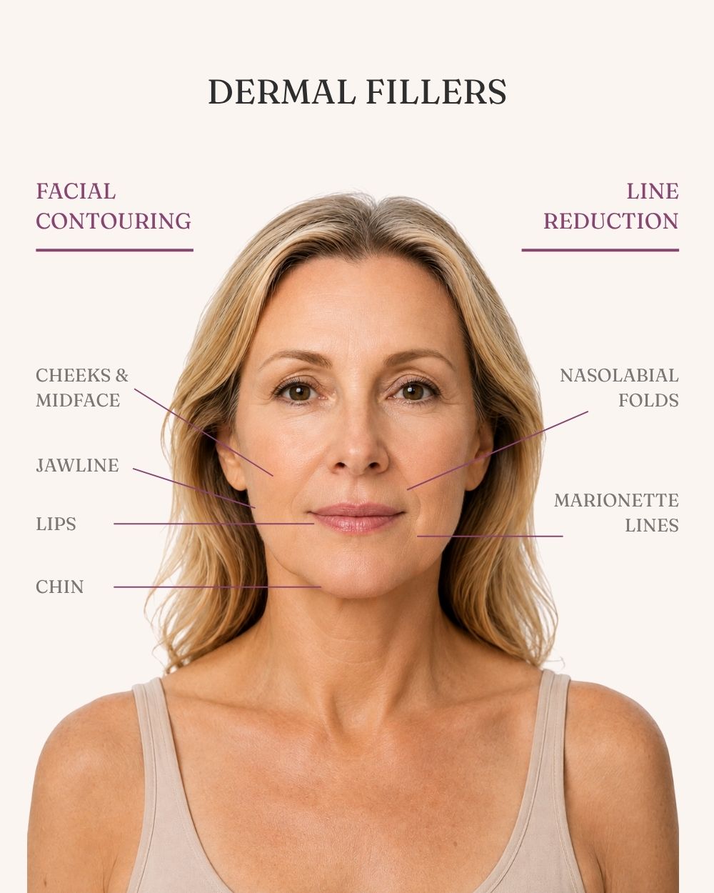 What Are Dermal Fillers Brisbane What Are Dermal Fillers?