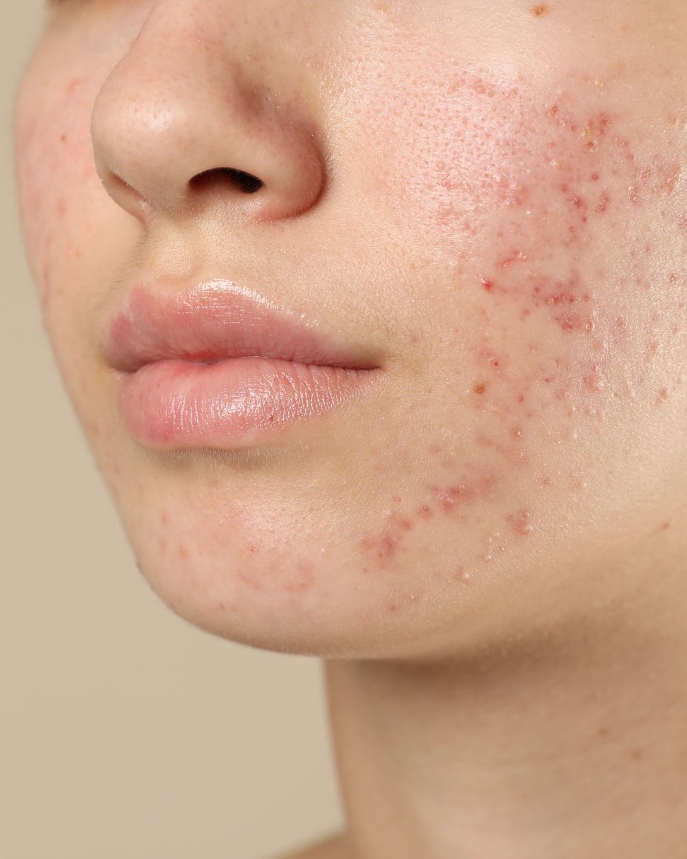 What Are Medical Skin Treatments What Are Medical Skin Treatments?